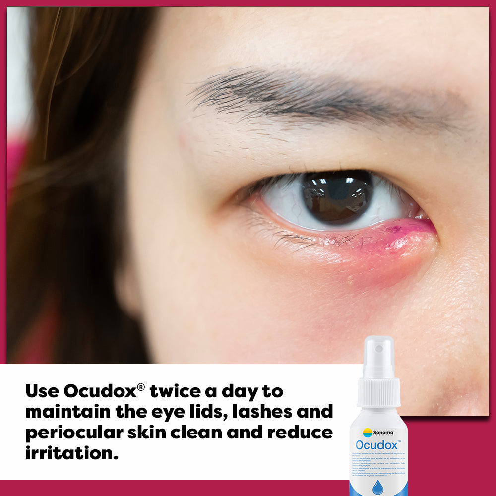 Ocudox - Eye Care